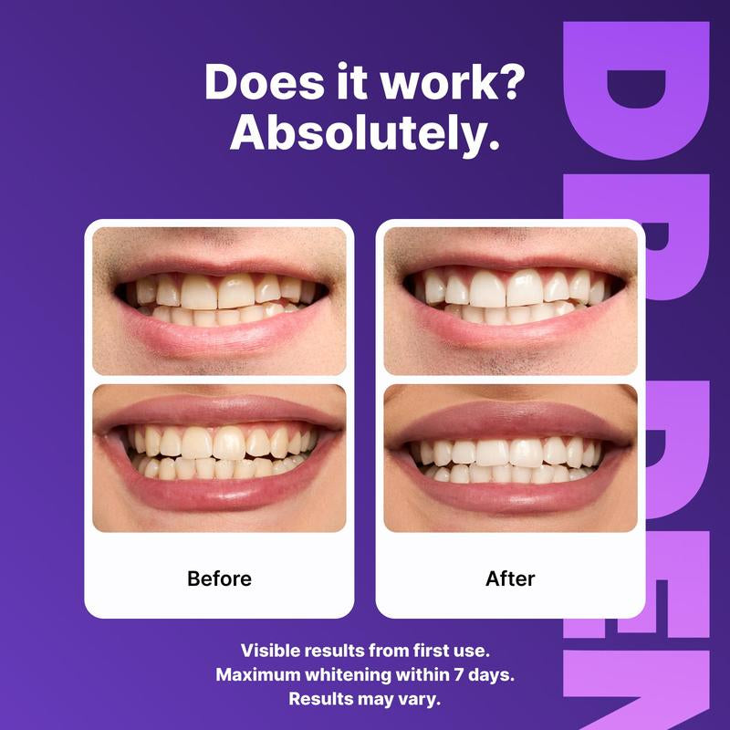 Revitalize Your Smile with DR.DENT Purple Teeth Whitening Strips - 7 or 21 Sessions of Enamel-Safe, Sensitive-Free Whitening!